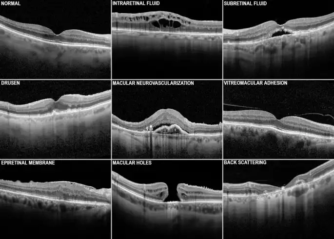 Grey's Project - analyse imagerie médicale par IA